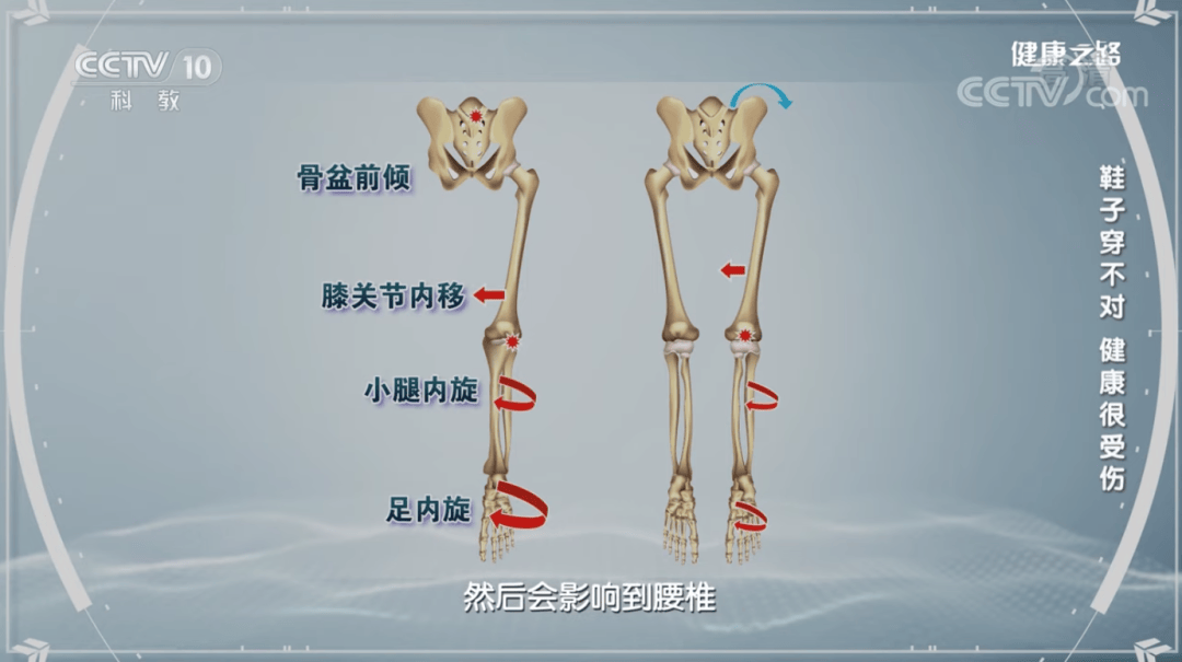 万的“踩屎感”正在毁掉你的脚必一体育运动app月销10(图5)